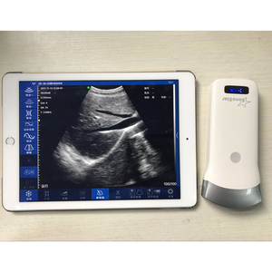 Escáner de sonda de ultrasonido B inalámbrico de matriz en fase convexa lineal de 80 elementos, instrumento veterinario para uso en hospitales/clínicas - Product Image 4