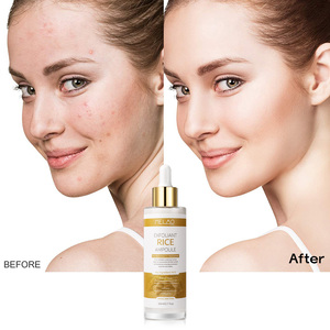 Chăm sóc da mặt Peel Shot Exfoliant gạo đen Ampoule huyết thanh Niacinamide làm sáng lỗ chân lông thu hẹp vỏ bắn Glow gạo Ampoule - Product Image 6