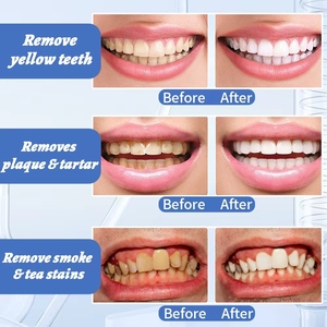 Pasta Dental Profesional Blanqueadora y Eliminadora de Manchas con Sabor a Menta Fresca, 100g, Mercado Principal Latinoamérica - Product Image 5