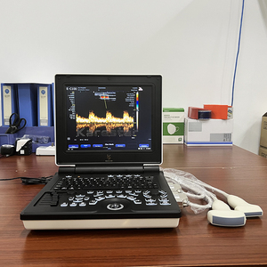 Laptop portabel kinerja tinggi warna pemindai <span class=keywords><strong>Ultrasound</strong></span> Harga instrumen <span class=keywords><strong>Ultrasound</strong></span> medis - Product Image 2