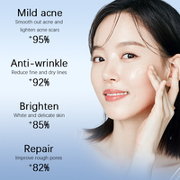 80% algues Peel Peeling de la peau Traitement Spongilla Spicules Liquide Blanchiment du visage pour l'acné Pigmentation OEM Personnalisation