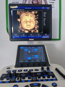 Siêu âm xách tay Thiết bị chẩn đoán tim mạch máu siêu âm DOPPLER màu Echo máy siêu âm - Product Image 4