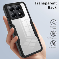 Coque de téléphone complète à 360 degrés pour Xiaomi Mi 15/15 Pro/14T/14 Pro clair Tpu + acrylique + protecteur d'écran avant pour animaux de compagnie