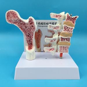 Modèle d'anatomie de l'ostéoporose du fémur humain PVC jambe os coupe transversale tranche vertébrale pathologique vertèbres lombaires pour la science médicale - Product Image 4