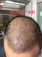 Shampooing au gingembre pour la perte de cheveux, produit de croissance capillaire, ml, afro et japonais