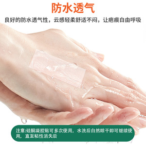 แผ่นซิลิโคนปิดแผล BCK ขนาด 4 ซม. x 10 ม. ช่วยให้แผลเรียบเนียนลง สำหรับแผลเก่าและแผลใหม่ - Product Image 3