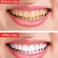 Onuge दांत Whitening उत्पाद नारियल तेल में दांत Whitening स्ट्रिप्स