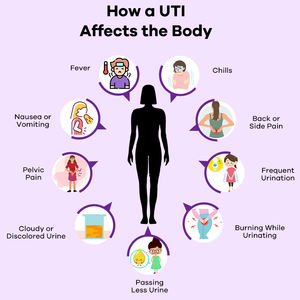 Poudre de D-Mannose Biologique OEM, Complément Naturel pour le Soutien des Infections Urinaires, pour Nettoyer et Purifier les Voies Urinaires, Poudre de D-Mannose + Canneberge pour les Infections Urinaires - Product Image 4