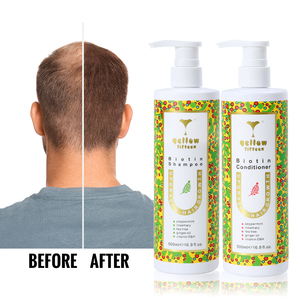 El mejor champú y acondicionador para el crecimiento del cabello de biotina OEM, espesante de jengibre, champú anticaída para el crecimiento del cabello, champú para el crecimiento del cabello para hombres - Product Image 1