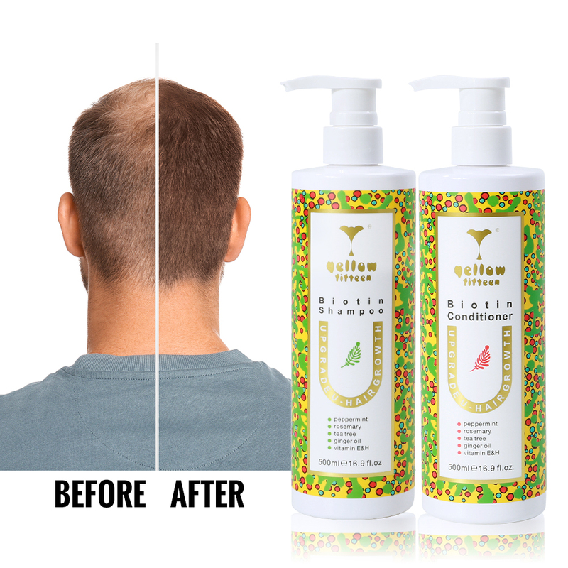 Private Label Rosemary Anti Dandruff Shampoo