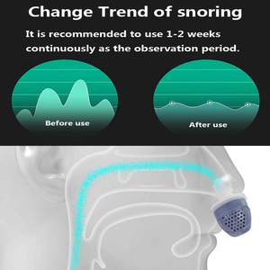 <span class=keywords><strong>2025</strong></span> mới đến Chống Ngáy thiết bị điện chống ngáy Thiết bị chống ngưng thở sản phẩm - Product Image 5