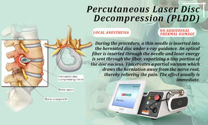 Descompresion laser diodo <span class=keywords><strong>intradiscal</strong></span> 980nm 1470nm PLDD disco spinale fisioterapia per ernia disco medico chirurgico macchina - Product Image 2