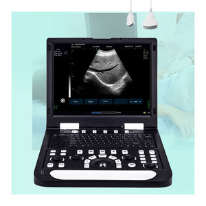 휴대용 초음파 기계 하이 엔드 <span class=keywords><strong>PC</strong></span> 기반 노트북 BW 초음파 스캐너 병원 장비 인간을위한 초음파 기계 - Product Image 1