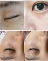 Machine de beauté pour l'épilation et le rajeunissement de la peau M22 pour salon de beauté à vendre