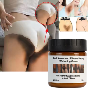 Nhãn Hiệu Riêng Cực Làm Trắng Chống Tối Tại Chỗ Lão Hóa Nếp Nhăn Đầu Gối Khuỷu Tay Mạnh Mẽ Vitamin Trắng Kem Dưỡng Da Mặt Cơ Thể Làm Trắng Kem - Product Image 1