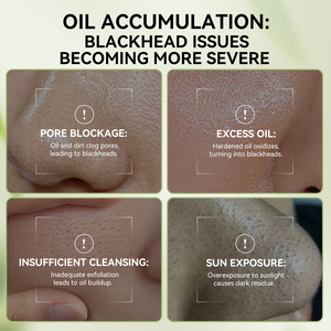 <span class=keywords><strong>Lanbena</strong></span> nueva llegada removedor de espinillas poros suero retráctil y tiras de poros de la nariz conjunto de cuidado de la piel - Product Image 2