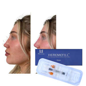 Inyector de Ácido Hialurónico <span class=keywords><strong>para</strong></span> Nariz y <span class=keywords><strong>Labios</strong></span>, Jeringa <span class=keywords><strong>para</strong></span> Relleno Dérmico HA, Pluma de Ácido Hialurónico <span class=keywords><strong>para</strong></span> Relleno Dérmico de Nariz y <span class=keywords><strong>Labios</strong></span> - Product Image 3