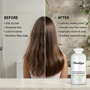 Shampooing Hydratant et Lissant à l'Huile d'Amande et d'Avocat, Anti-Dessèchement, Réparateur <span class=keywords><strong>pour</strong></span> Cheveux Abîmés, Marque Blanche, <span class=keywords><strong>pour</strong></span> Femmes Enceintes - Product Image 3