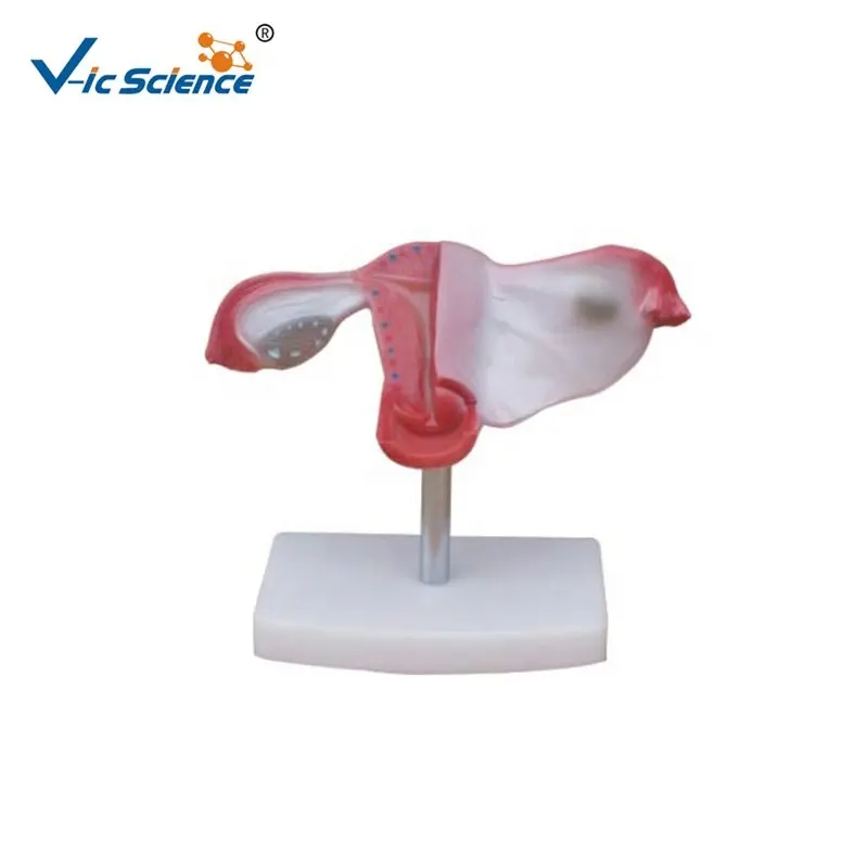 Naturelles Uterusmodell Uterinmodell menschliches Uterusmodell