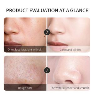 Masque facial à bulles <span class=keywords><strong>de</strong></span> <span class=keywords><strong>charbon</strong></span> <span class=keywords><strong>de</strong></span> bambou Auto-hydratant Nettoyage en profondeur des pores Ingrédients à base <span class=keywords><strong>de</strong></span> plantes Peau sèche OEM Masque anti-acné - Product Image 5