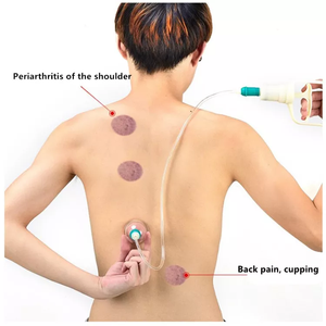 Pistolet à <span class=keywords><strong>ventouse</strong></span> <span class=keywords><strong>Hijama</strong></span>, <span class=keywords><strong>prix</strong></span> de gros - Product Image 3
