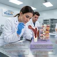 Modelo Anatómico de Patología de Densidad Ósea, Ayuda de Demostración Científica Popular sobre Osteoporosis, CE/ISO/ROHS/CNAS