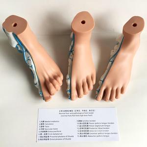 Podiatri Öğretimi için 3 Çeşit Ayak Kemeri Anatomisi Modeli Normal Düz ve Yüksek Kemerli Ayaklar - Product Image 5