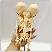 Modèle de squelette fœtal humain à double tête, crâne déformé, modèle anatomique, ressource pédagogique pour les malformations congénitales