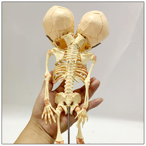 Modelo de Esqueleto Humano de Bebé para Ciencias Médicas, Esqueleto de Feto de Doble Cabeza, Modelo de Cráneo con Deformidad, Recurso Experimental - Product Image 4