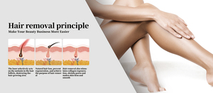 <span class=keywords><strong>2025</strong></span> New arrivals 3 trong 1 tẩy lông bằng laser alexandrite Máy tẩy lông bằng laser giá - Product Image 6