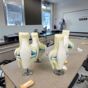 Modelo de Esqueleto Humano de <span class=keywords><strong>Rodilla</strong></span> con Osteoartritis de 4 Etapas para Enseñanza Médica y Demostración Ortopédica - Product Image 2