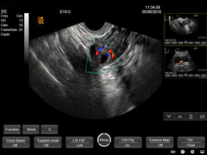 Robuuste Draagbare Veterinaire Echografie Machine Bmv Pt50a/C 15 ''Hoge Resolutie Lcd Monitor 2-12Mhz <span class=keywords><strong>Transducer</strong></span> Voor Gemakkelijk - Product Image 6