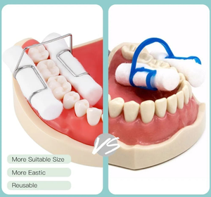Clip de Ortodoncia Dental de Acero Inoxidable Autoclavable Directo de Fábrica, Portarrollos de Algodón de 4 Piezas para Uso Dental - Product Image 4