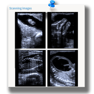 Alta Qualidade B/W Veterinária Ultrassom Machine Scanner à Venda Premium <span class=keywords><strong>Instrument</strong></span> Equipment - Product Image 5