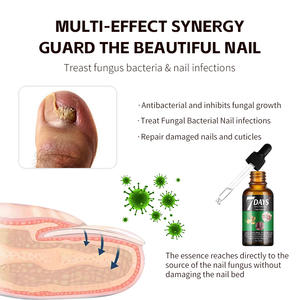 OEM vente en gros 7 jours sérum de traitement des champignons des ongles <span class=keywords><strong>produit</strong></span> de soin naturel pour la peau réparation des dommages aux ongles 30ml sérum de traitement des ongles bio - Product Image 3