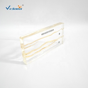Espécimen de Resina, Espécimen Anatómico de Ascaris Lumbricoides, Espécimen Bioincrustado - Product Image 2