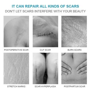 Crema Reparadora de Cicatrices al por Mayor de 20g con Fórmula Suave, Extracto de Plantas y Arbutina para el Cuidado Diario y la Reducción de Melanina - Product Image 2