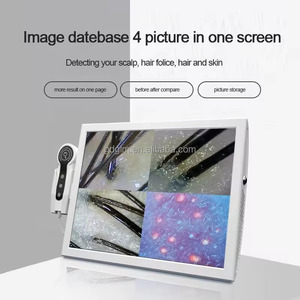 Analizzatore del Cuoio Capelluto di Grado Professionale da 15 Pollici, Scanner per Follicoli Capillari per Cliniche di Cura dei Capelli - Product Image 3