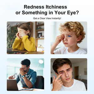 Lámpara de Hendidura Portátil Oftálmica Aist Optics FSL-P en Oferta - Product Image 6