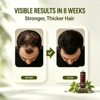 OEM/ODM Minyak Perawatan Rambut Semprot Alami Organik Asam Hialuronat Jahe untuk Perawatan Rambut Profesional Menutrisi Pertumbuhan Rambut dan Mengatasi Kerontokan