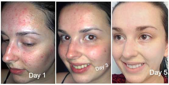 Hot Selling Natural Skin Care Facial Whitening Face Wash Vitamin C Cleanser