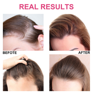 ELAIMEI Set di Polvere in Fibra <span class=keywords><strong>per</strong></span> <span class=keywords><strong>Capelli</strong></span> <span class=keywords><strong>per</strong></span> Donne, Nero e Marrone, Riempitivo <span class=keywords><strong>per</strong></span> <span class=keywords><strong>Capelli</strong></span> Sottili, Volumizzante, Microfibra <span class=keywords><strong>per</strong></span> <span class=keywords><strong>Capelli</strong></span> Più Folti e Spessi - Product Image 4