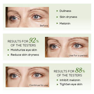 Suero en Crema para Ojos con Té Verde de 15 ml, Elimina las Bolsas de los Ojos, Aclara las Ojeras, Cafeína, Suaviza las Arrugas, Suero Antienvejecimiento para Ojos - Product Image 4