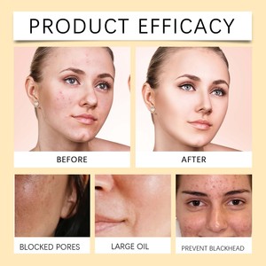Professionale per la cura del corpo Toner facciale naturale pianta Ginseng e acido glicolico idratante riparazione Acne mangiare con bottiglia di plastica - Product Image 5