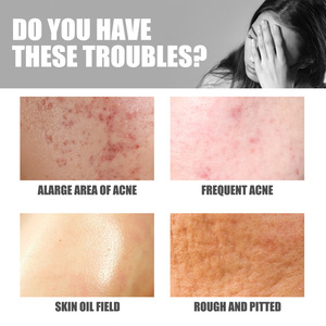 JAYSUING Lotion corporelle aux herbes 100ml Crème de soin éclaircissante contre l'acné pour les fesses - Product Image 6