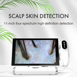 11 Inch HD Scalp Detector 50/200X Digital Hair Skin Analyzer Microscope for Hair Follicle Testing Skin Scalp Analyzer Magnifier - Product Image 3