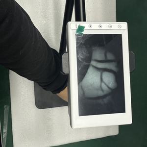 Detektor pembuluh darah inframerah Vascula, perangkat pencari Nadi visualisasi distribusi vaskula medis - Product Image 5