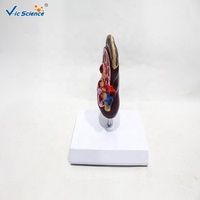 Modèle anatomique de rein humain démontable en PVC pour la néphrologie clinique et la démonstration pédagogique en anatomie CE/ISO/ROHS/CNAS