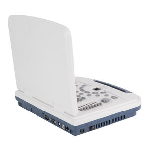 Instrumento de diagnóstico inalámbrico de doble cabezal de ultrasonido Doppler Color, instrumento de diagnóstico de ultrasonido de color portátil para hospitales - Product Image 6