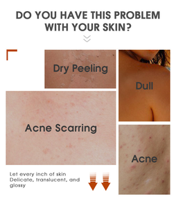 <span class=keywords><strong>Gel</strong></span> <span class=keywords><strong>Douche</strong></span> Éclaircissant au Glutathion et à l'Arbutine, Hydratant Naturel, Exfoliant et Blanchissant pour Tous Types de Peau - Product Image 5